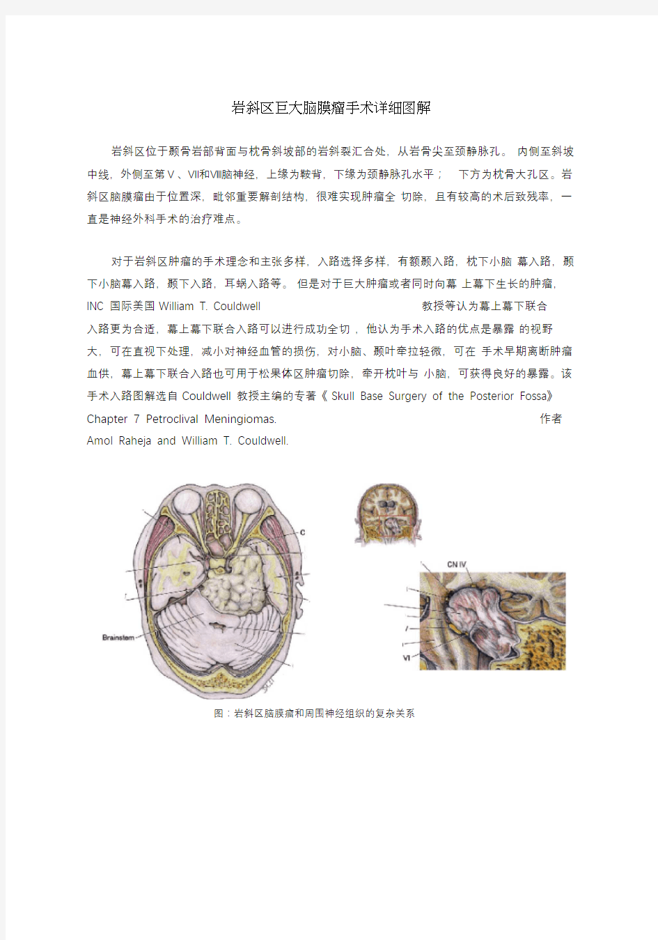 岩斜区巨大脑膜瘤手术详细图解