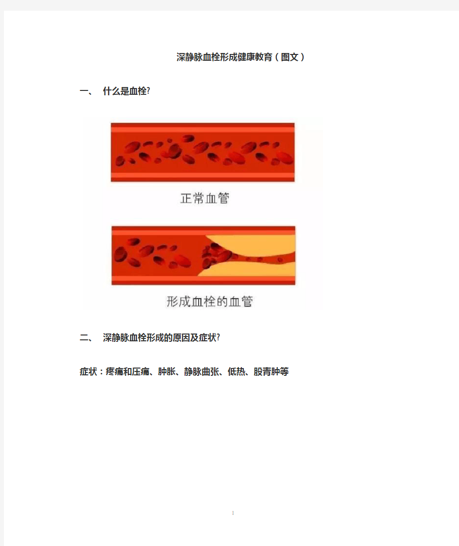 深静脉血栓形成健康教育(图文