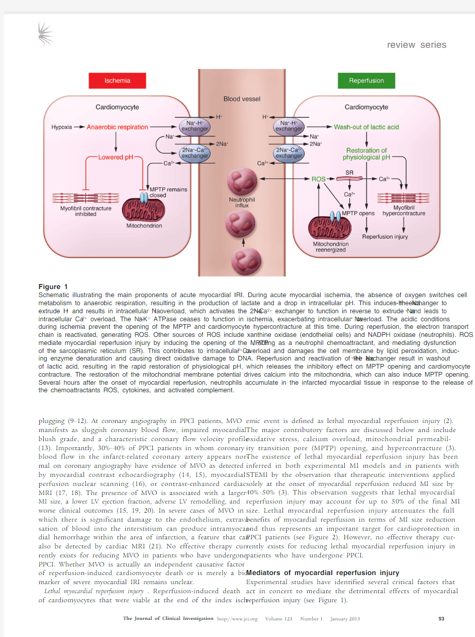 Myocardial ischemia-reperfusion injury_ a neglected therapeutic target