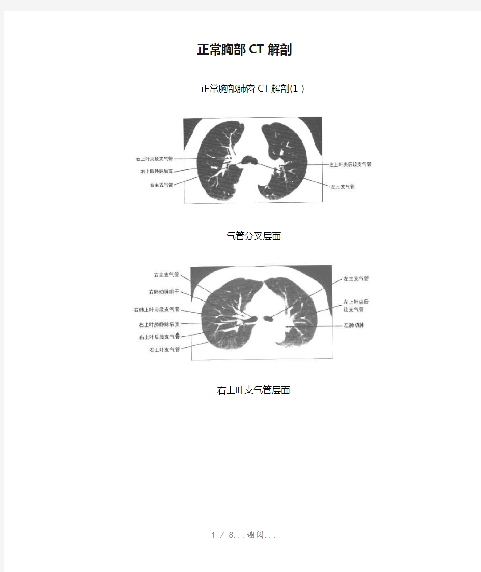 正常胸部CT解剖(最新知识点)