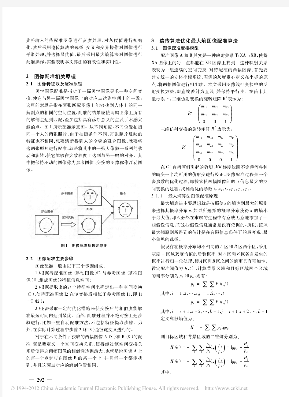 医学图像配准算法研究