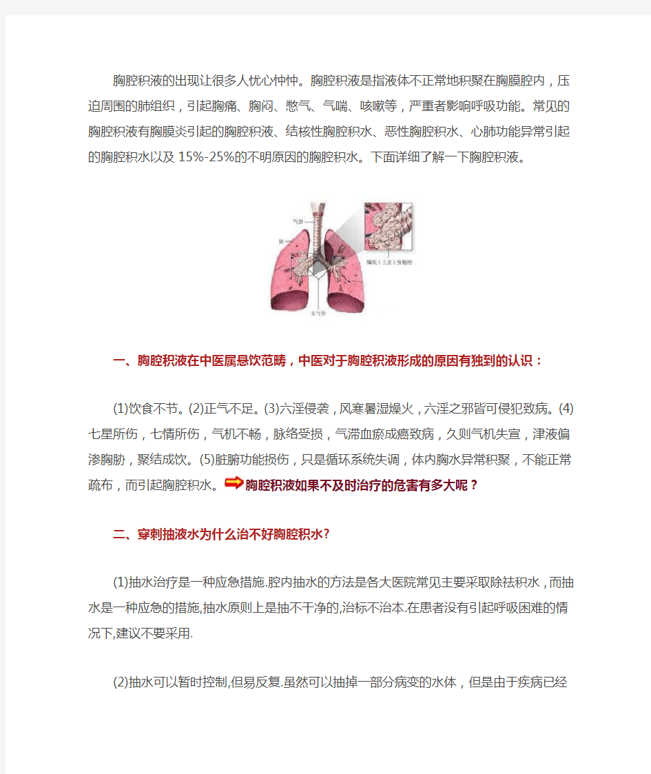 胸腔积液的出现让很多人忧心忡忡