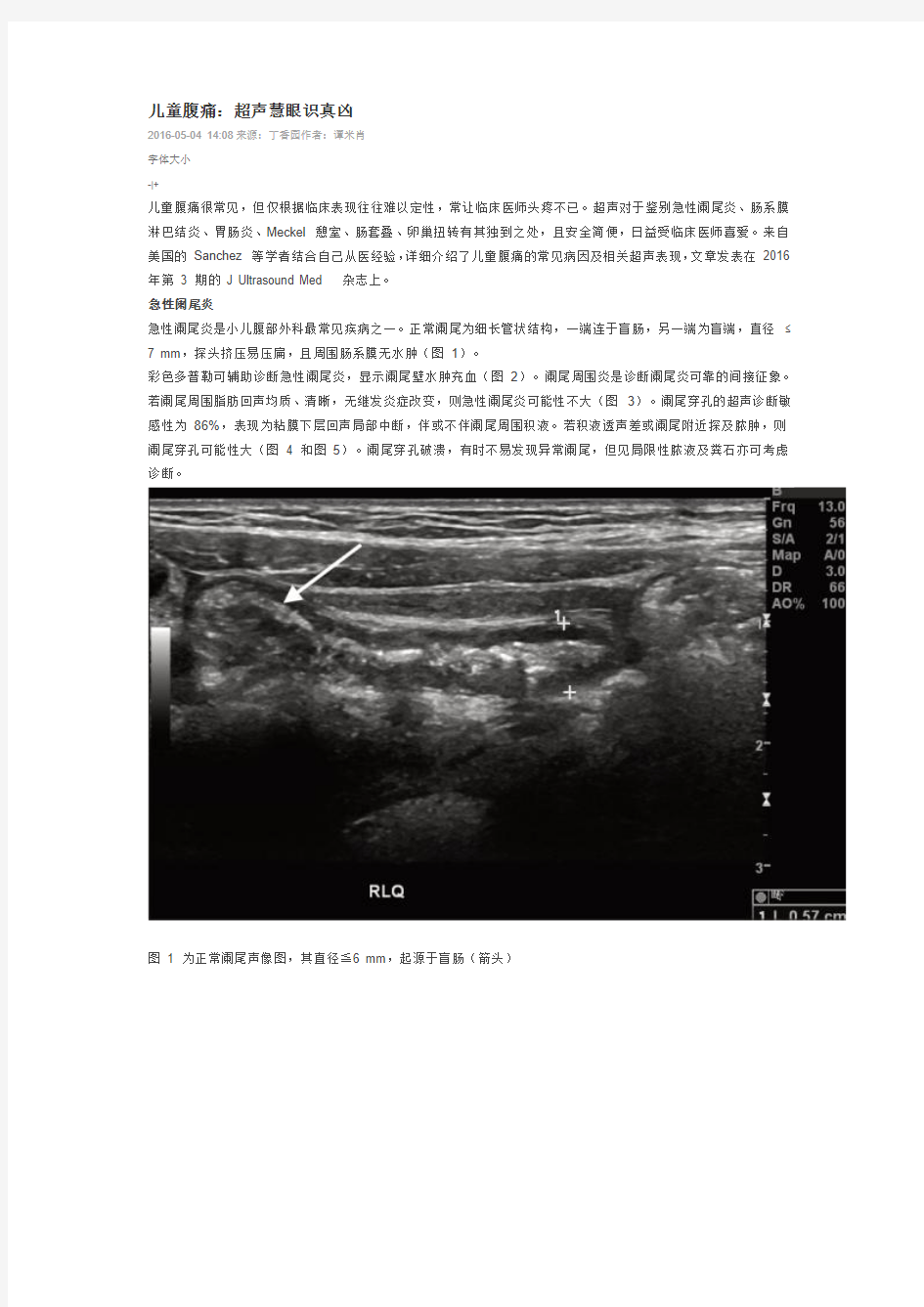 儿童腹痛：超声慧眼识真凶