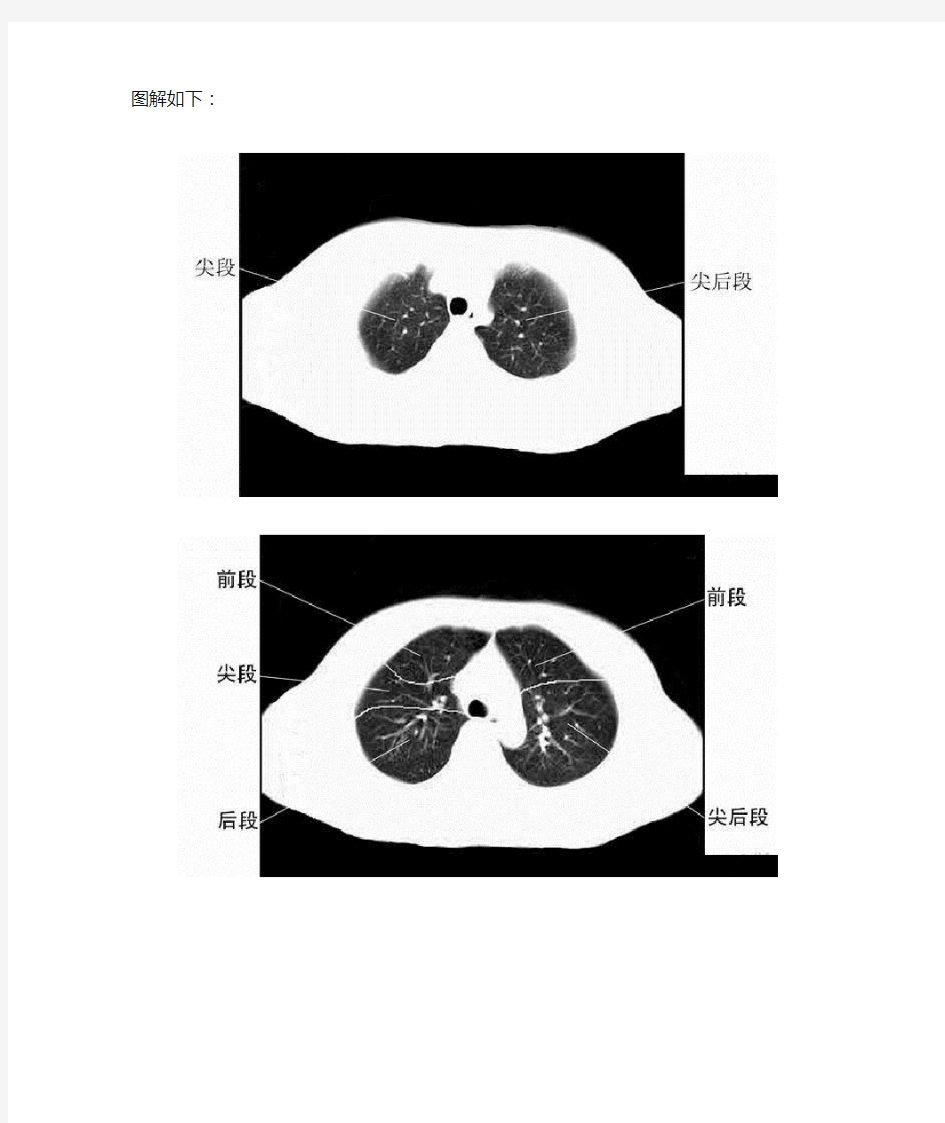 胸部CT肺段划分口诀