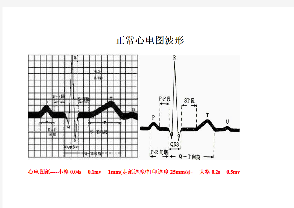 正常心电图波形特点