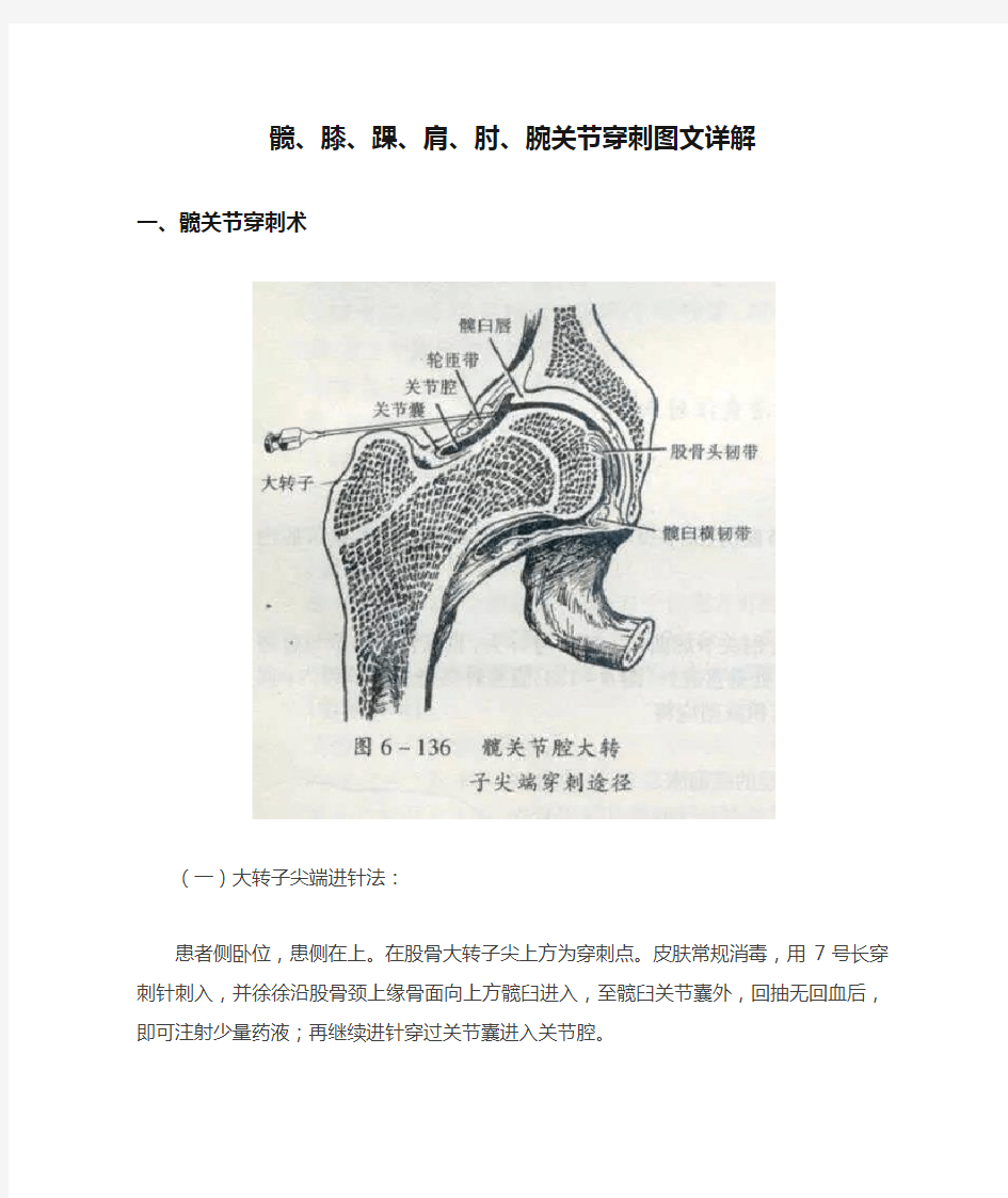 髋、膝、踝、肩、肘、腕关节穿刺图文详解