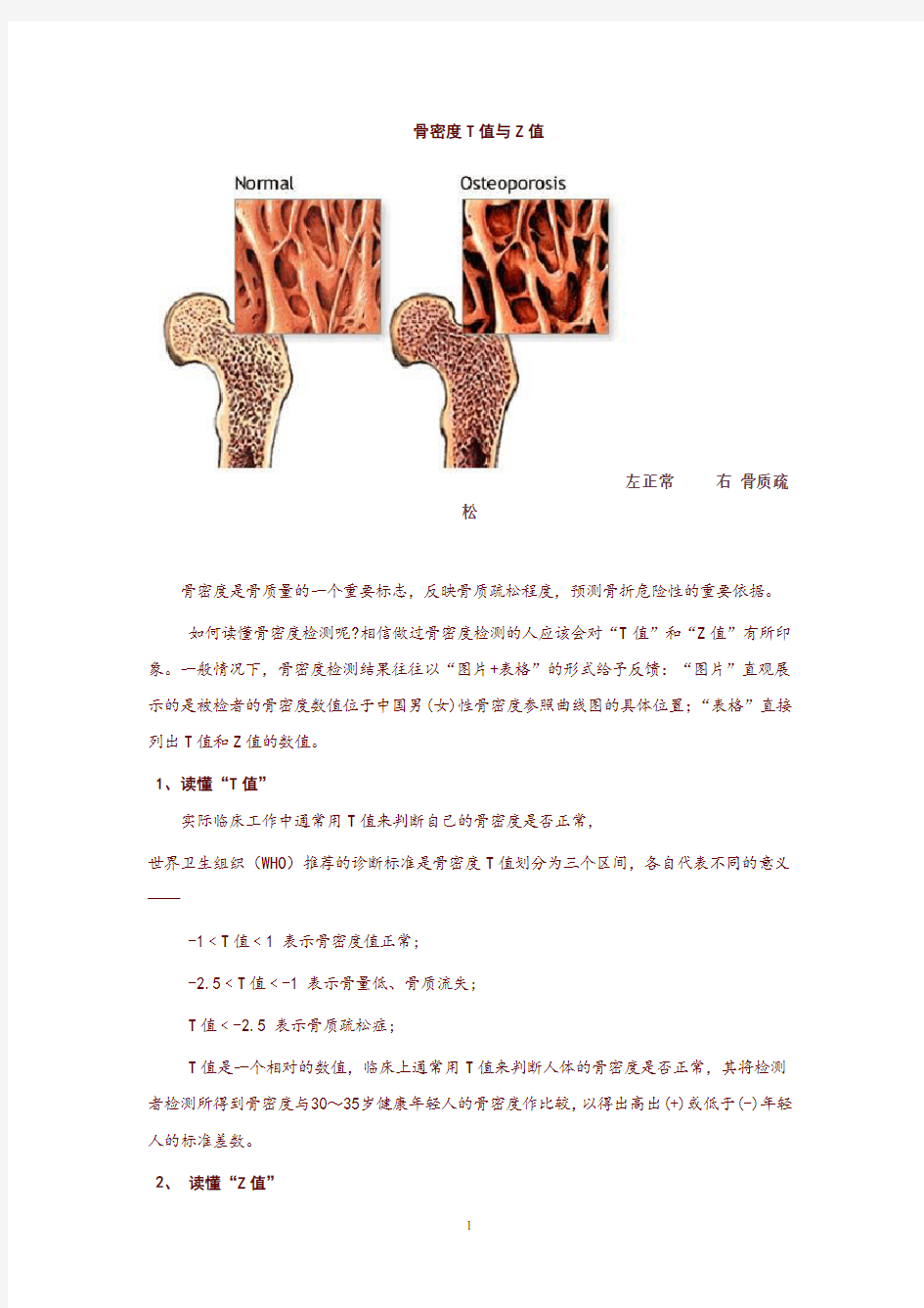 BMD-9超声骨密度参数及报告单说明