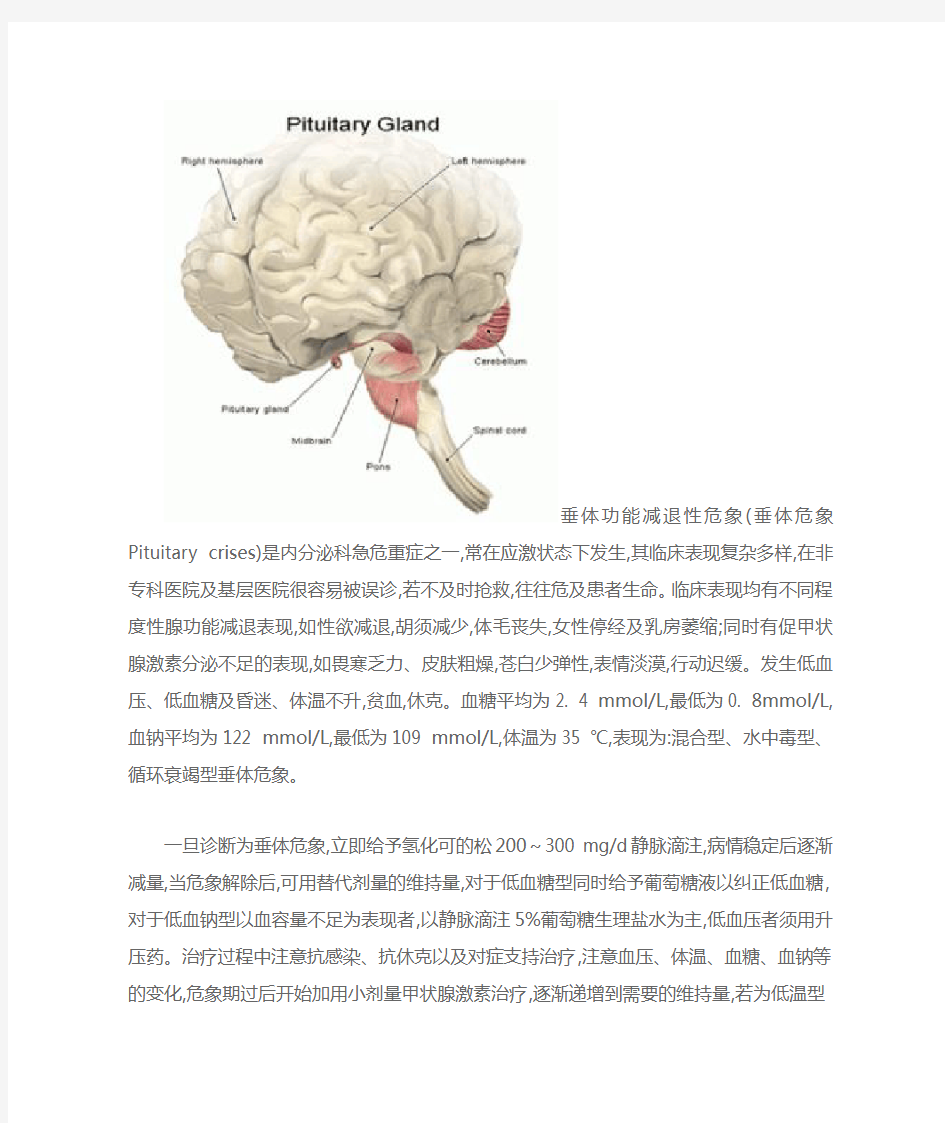 垂体危象