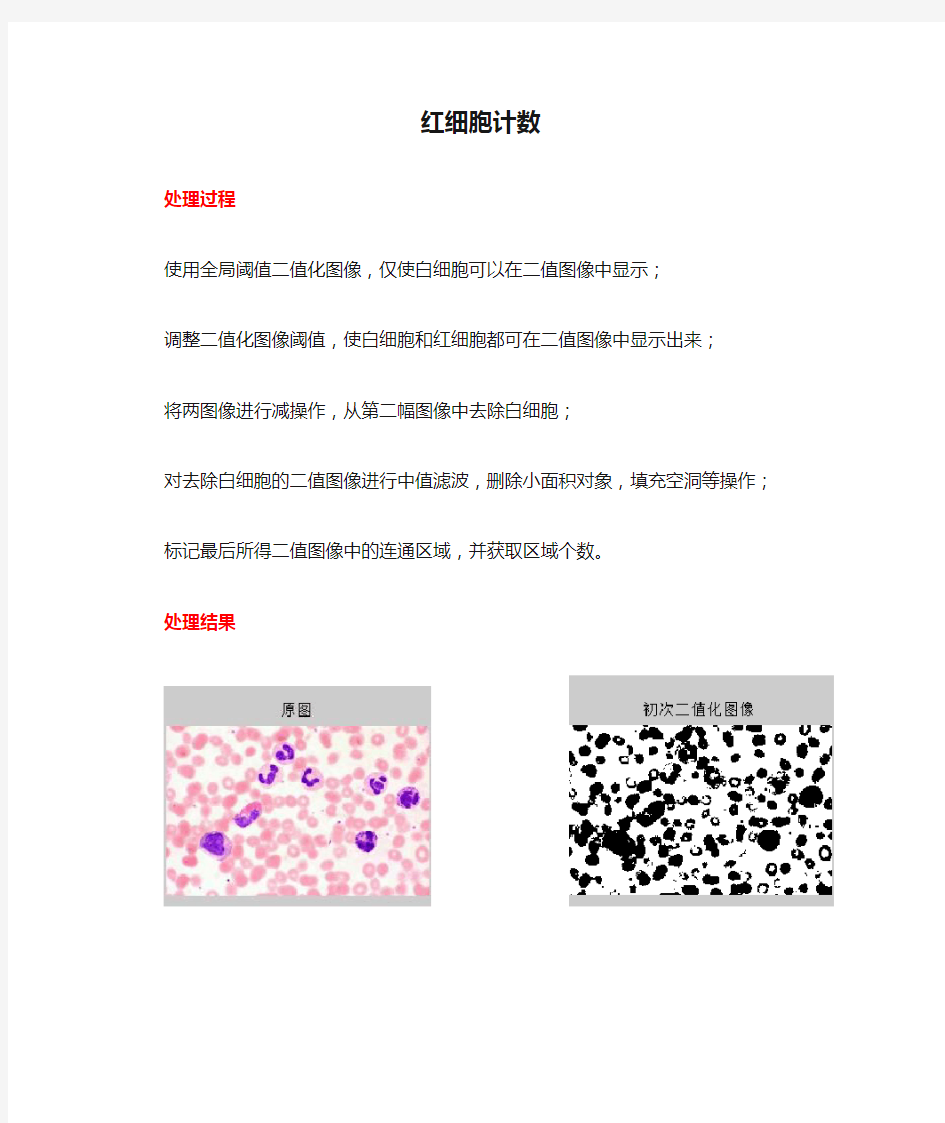 图像处理—红细胞计数(Matlab)