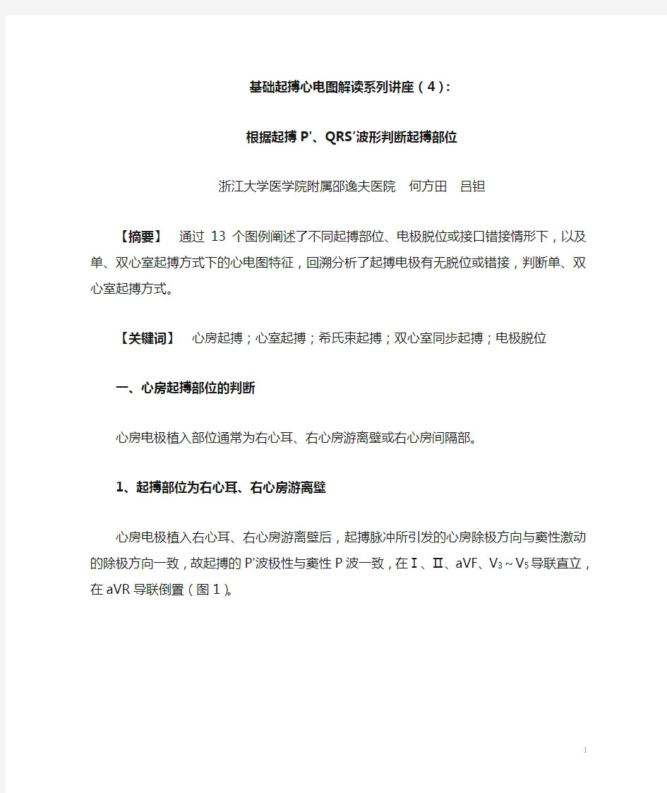 基础起搏心电图解读之四根据起搏P′、QRS′波形判断起搏部位