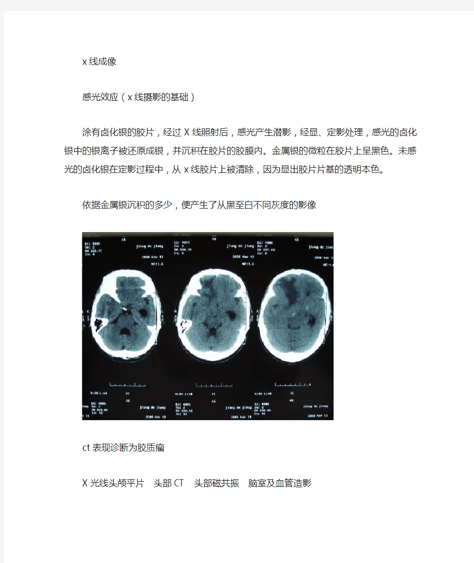 医学成像检查方法比较