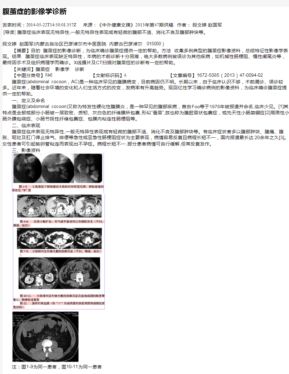 腹茧症的影像学诊断