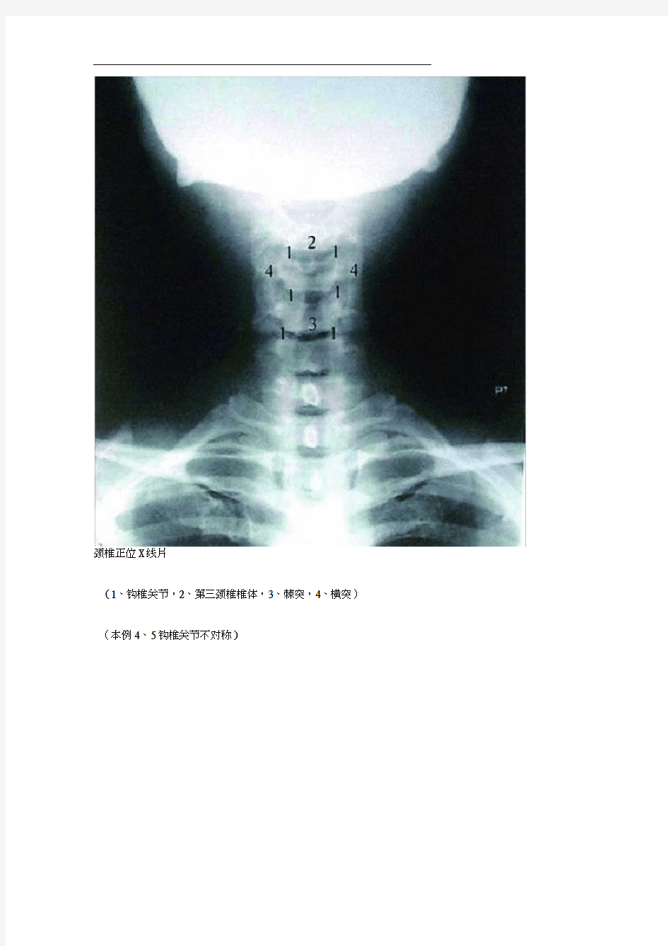 全脊柱影像学诊断