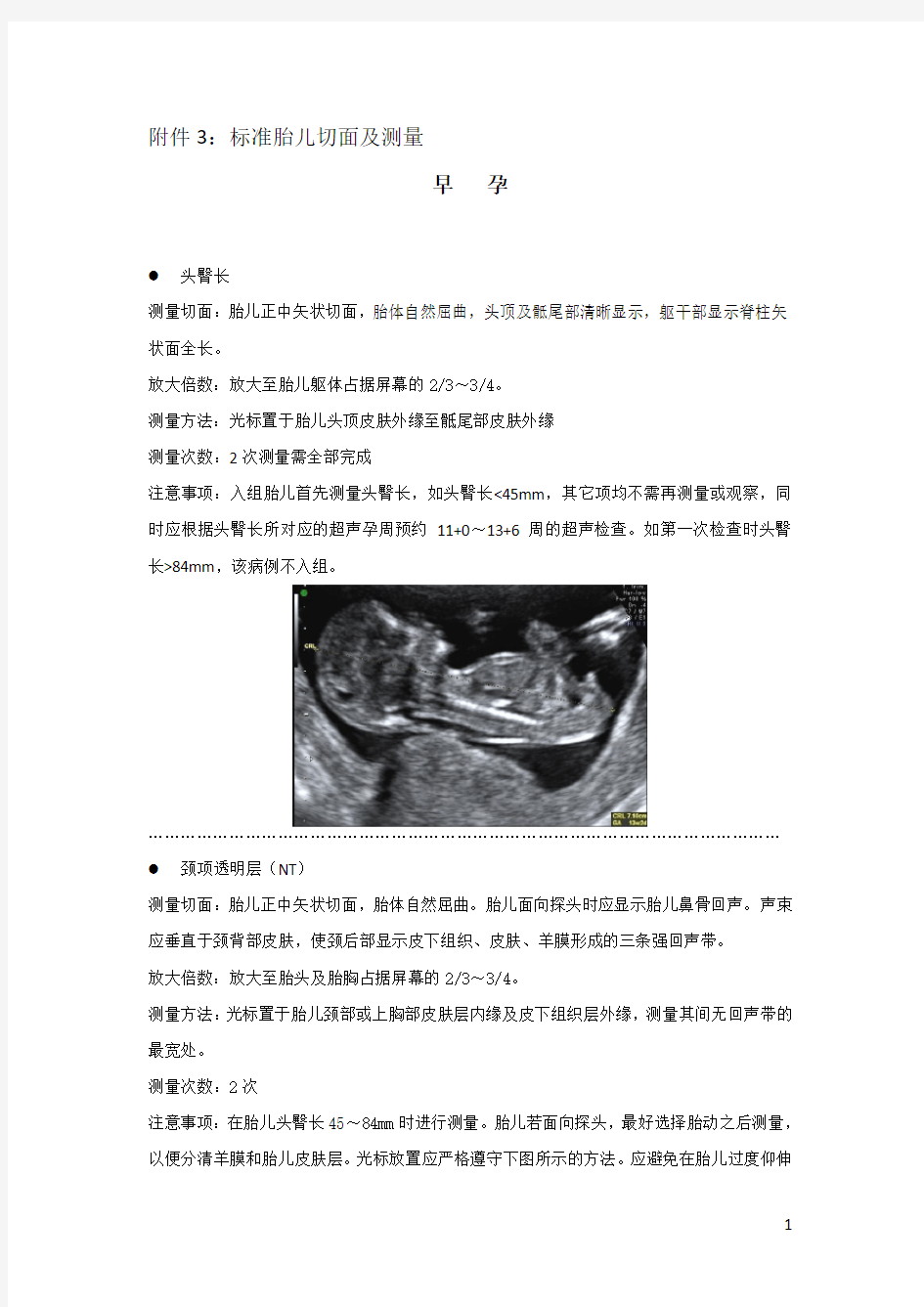 胎儿标准测量切面