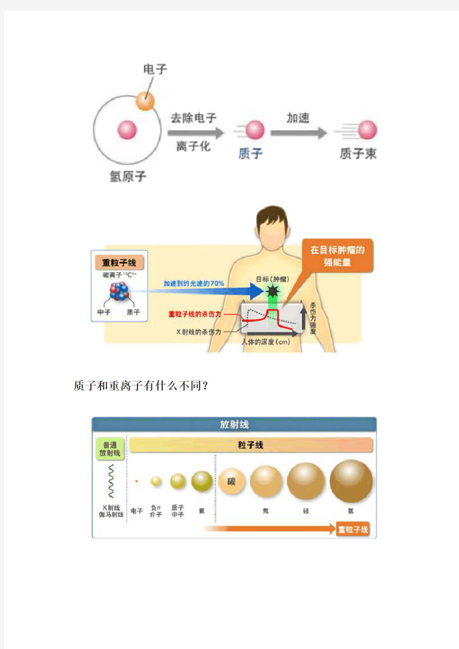 质子重离子治疗是癌症的终极克星