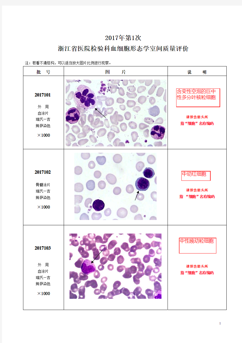 2017年第1次血细胞形态学EQA图(答案)