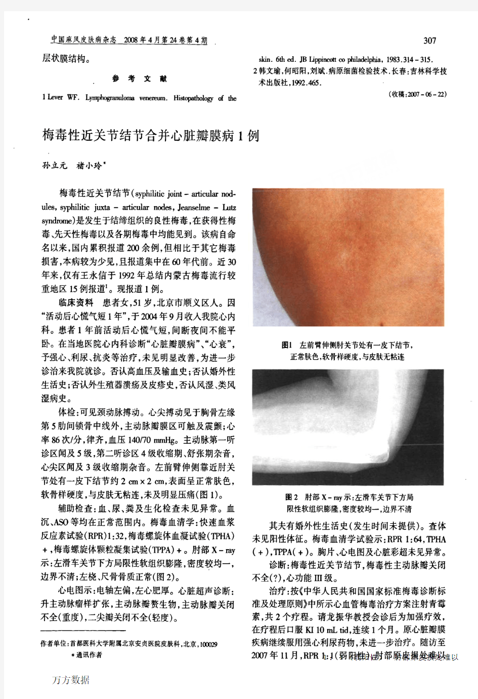 梅毒性近关节结节合并心脏瓣膜病1例