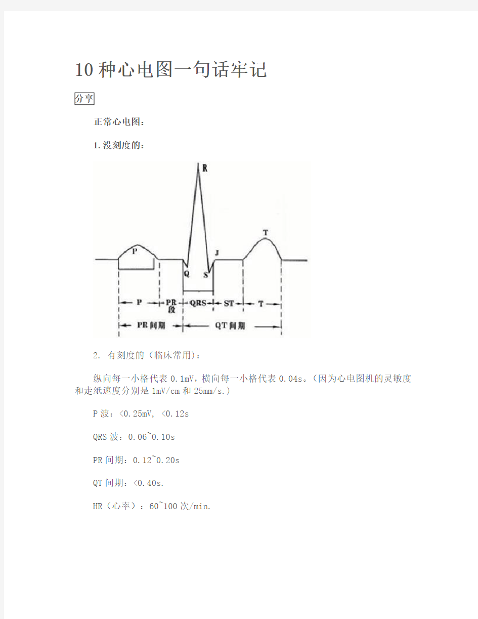 心电图口诀