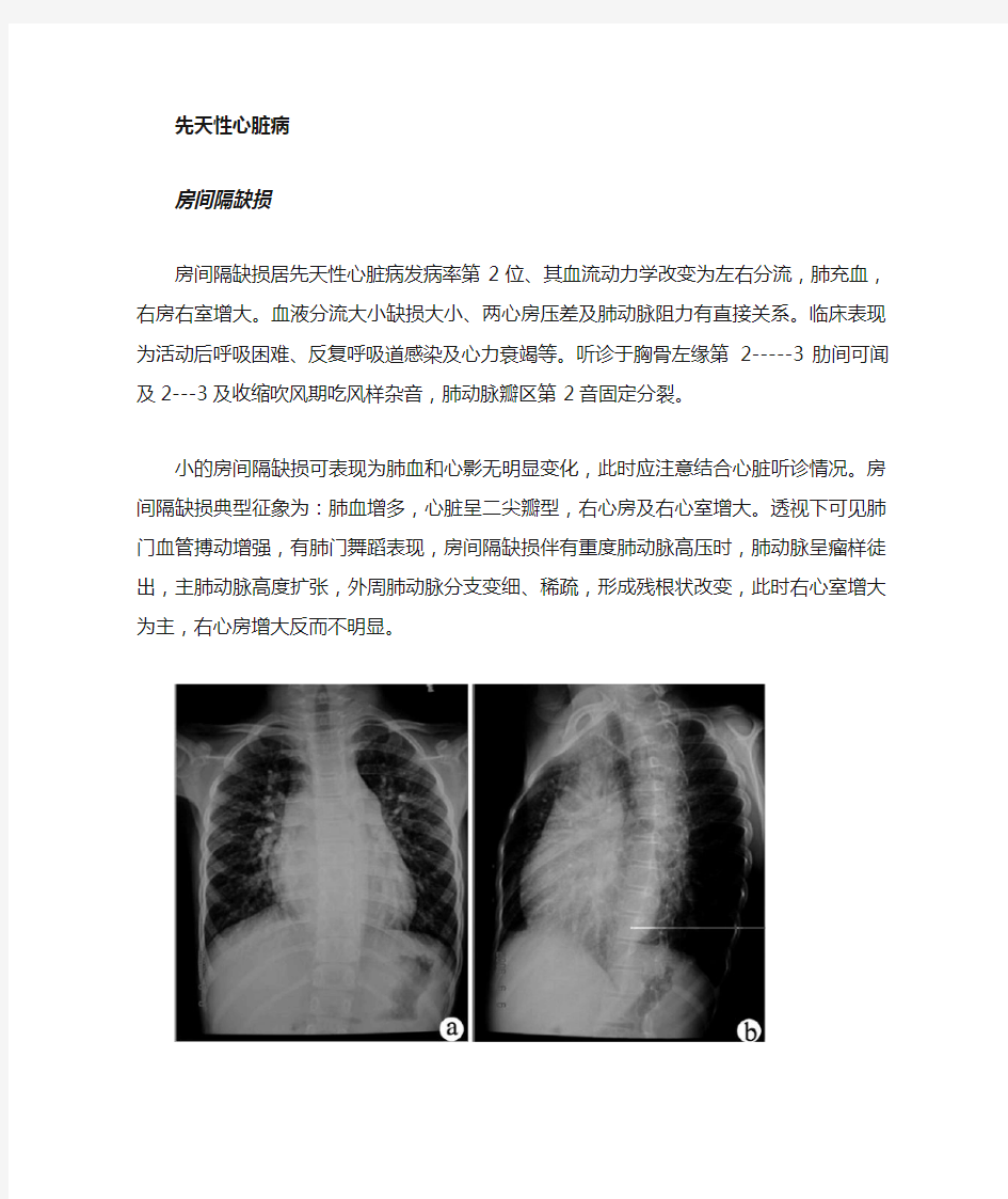 心内科-基本技能-心脏病X线图像的诊断