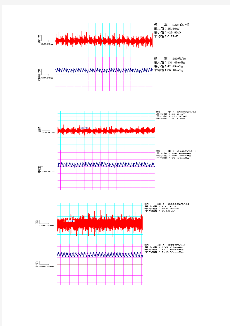 减压神经放电与动脉血压神经调节机制分析实验图