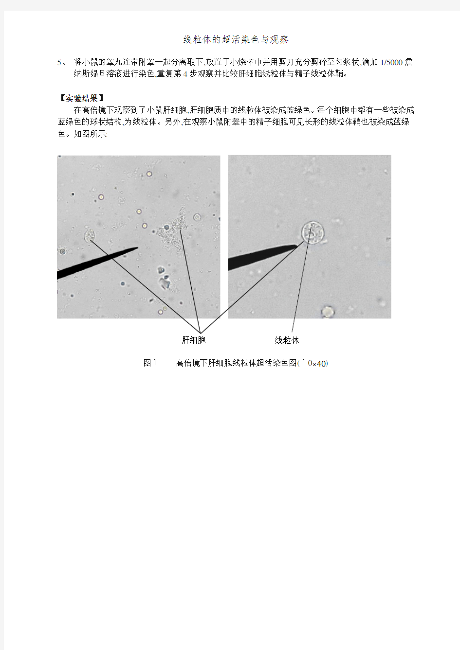 线粒体的超活染色与观察