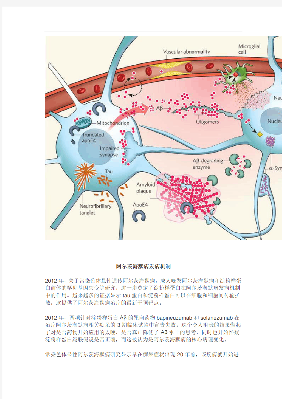 阿尔茨海默症的发病机制