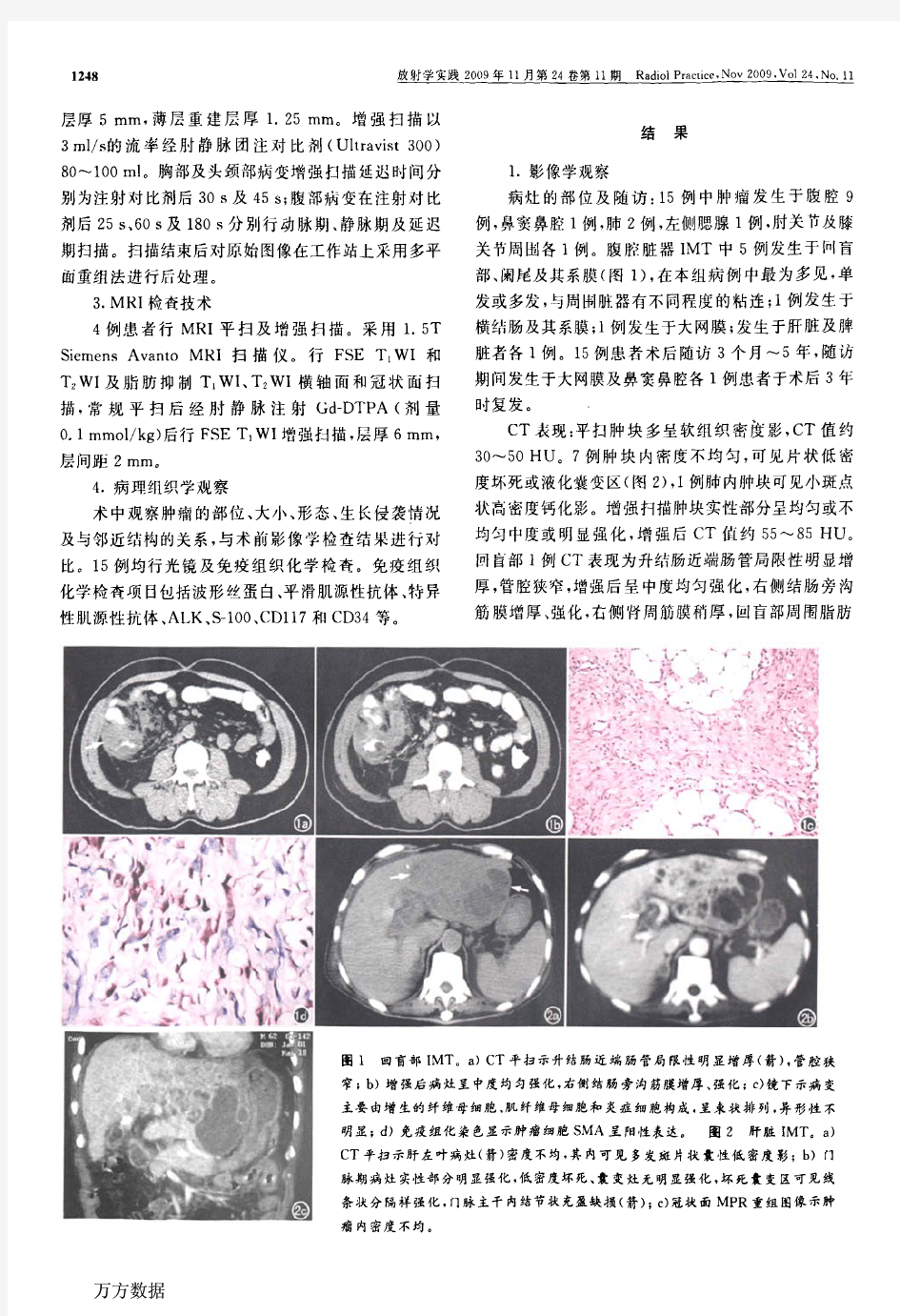 炎性肌纤维母细胞瘤的MSCT和MRI诊断