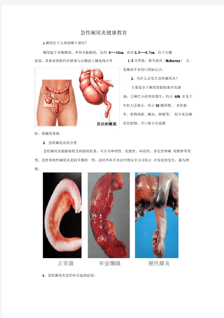 急性阑尾炎健康教育