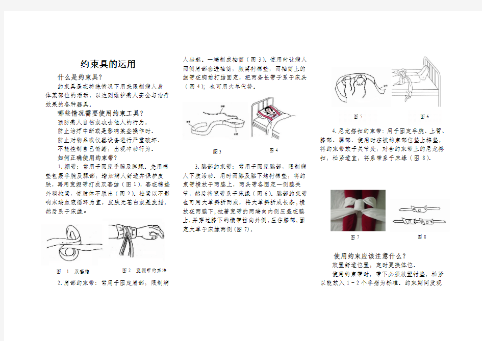 142-约束具的运用