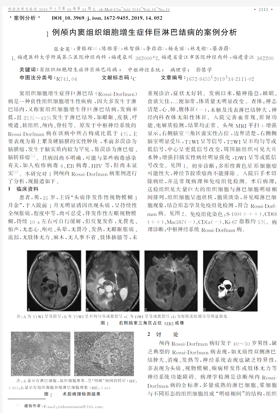 1例颅内窦组织细胞增生症伴巨淋巴结病的案例分析
