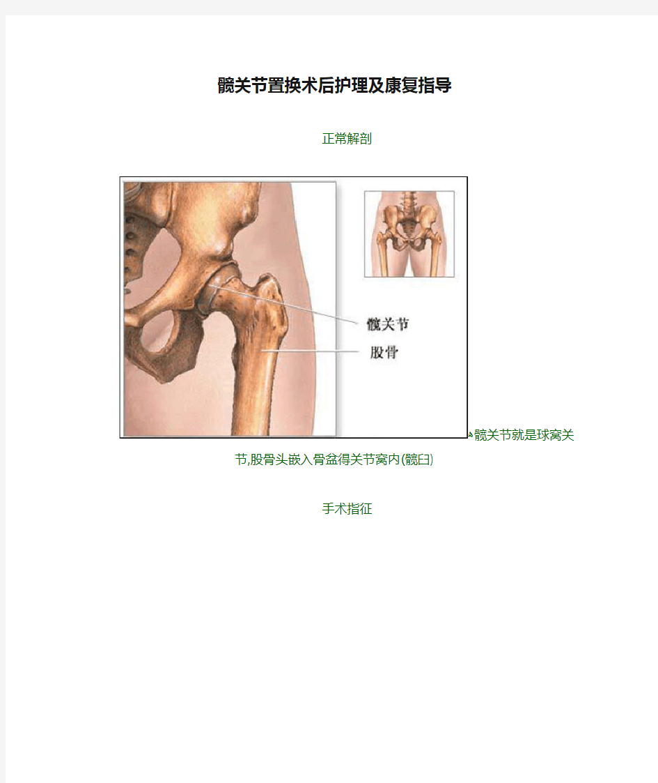 髋关节置换术后护理及康复指导