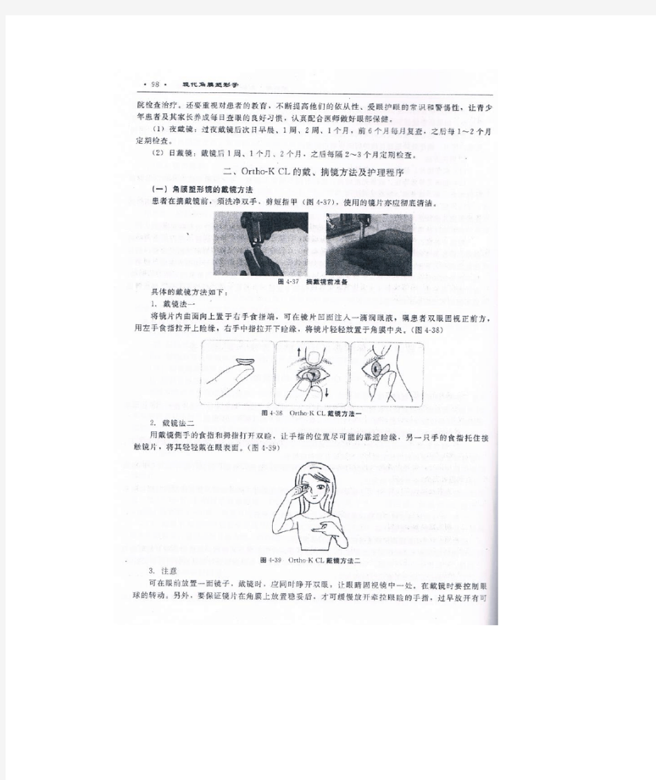 角膜塑形镜的正确佩戴方法