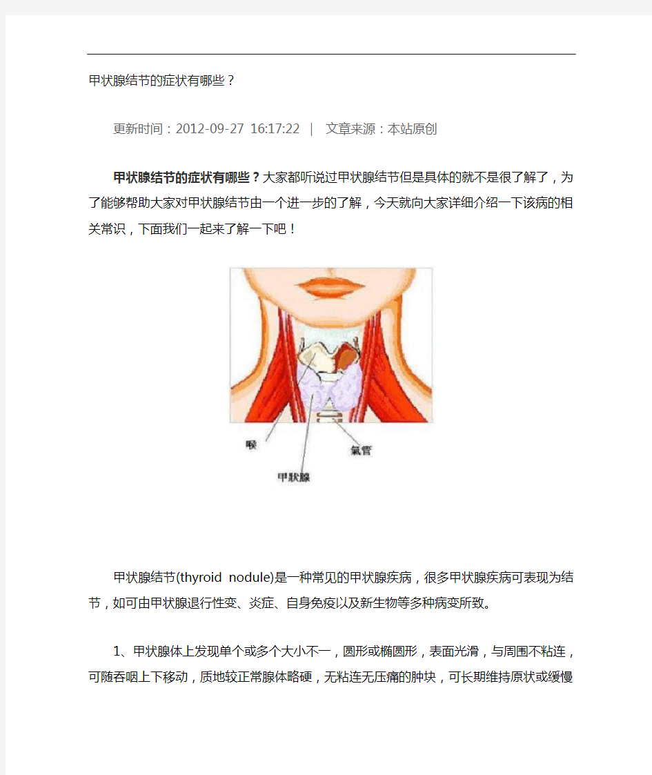 甲状腺结节有关的知识