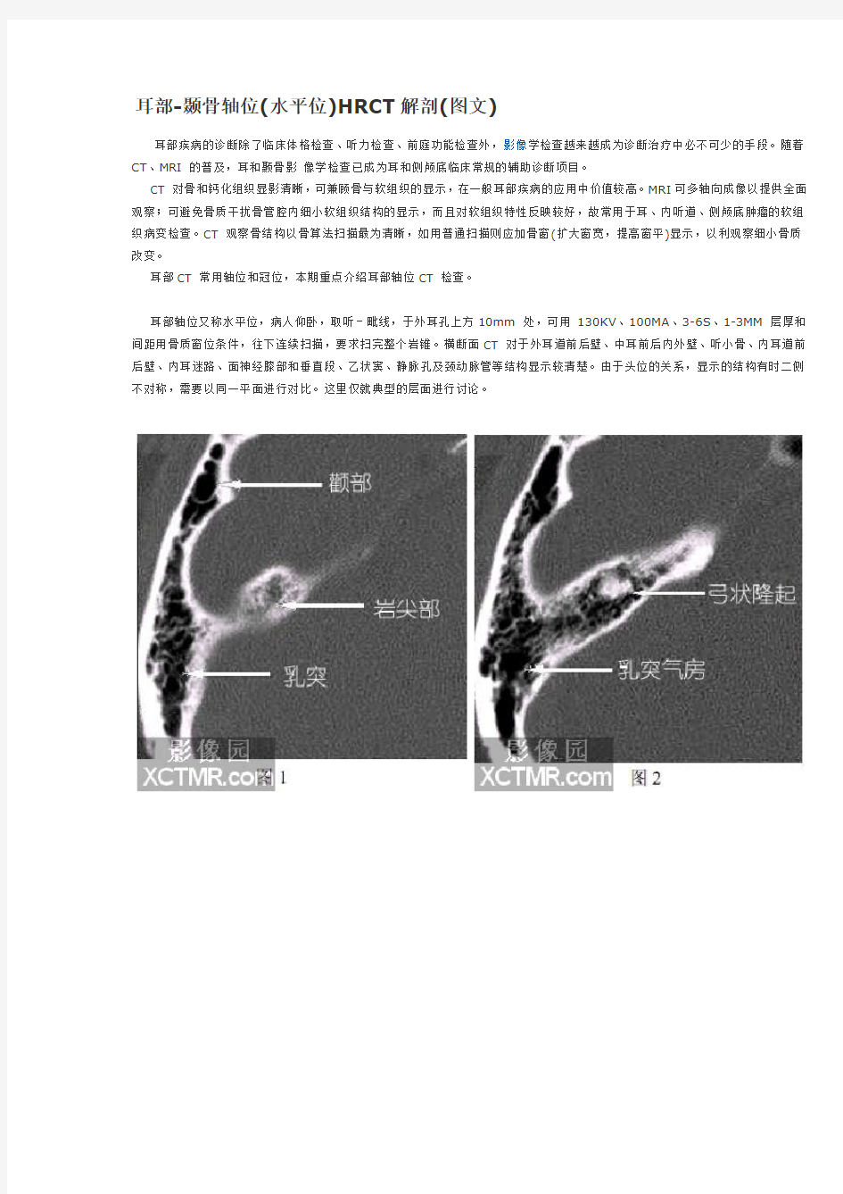 耳部CT解剖