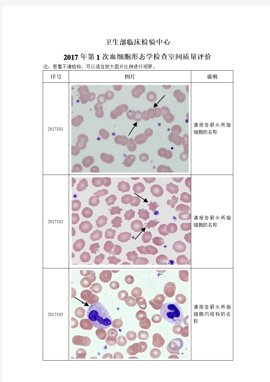 2017年卫生部血细胞形态学检查室间质量评价