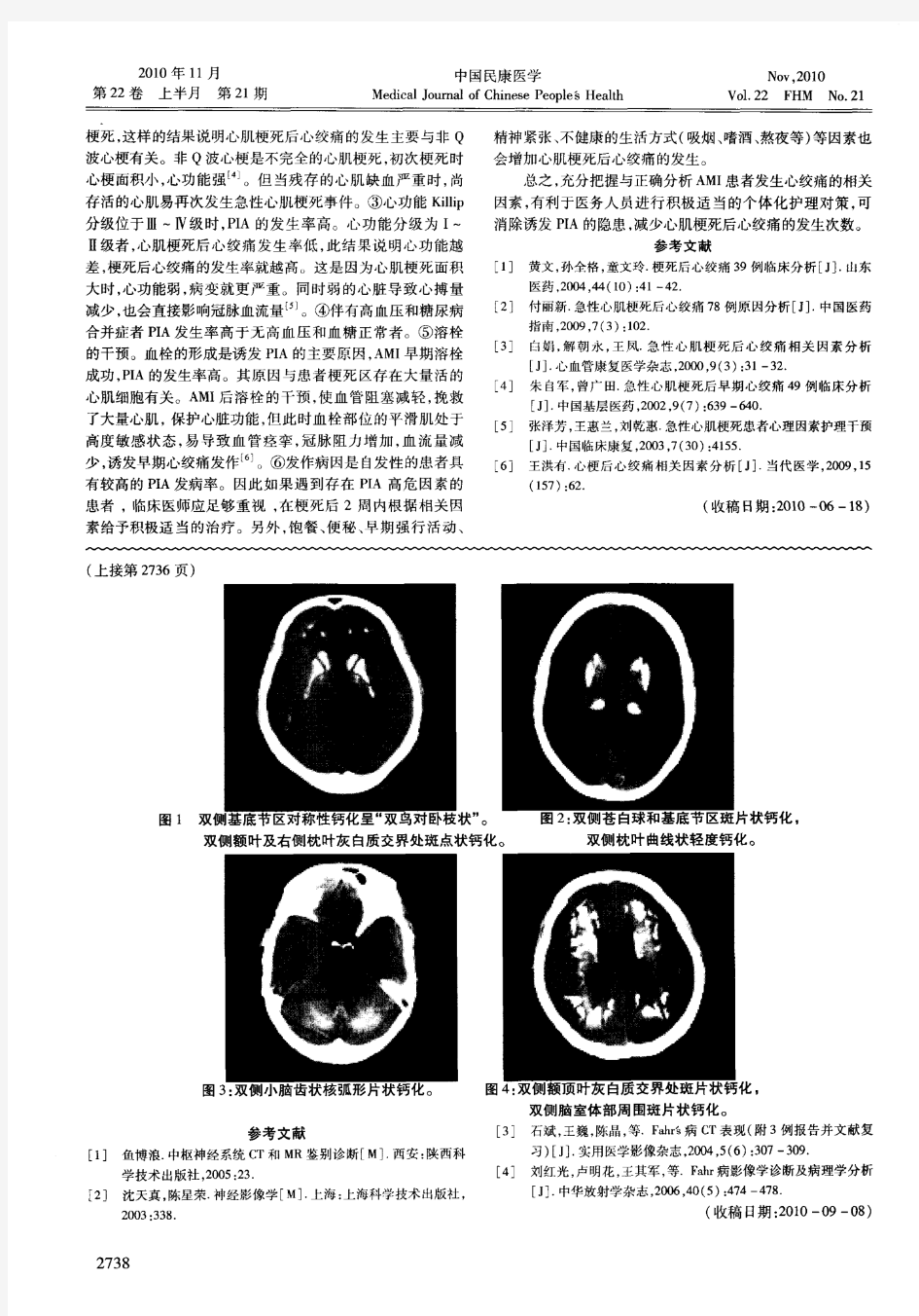 125例心肌梗死后心绞痛的相关因素分析