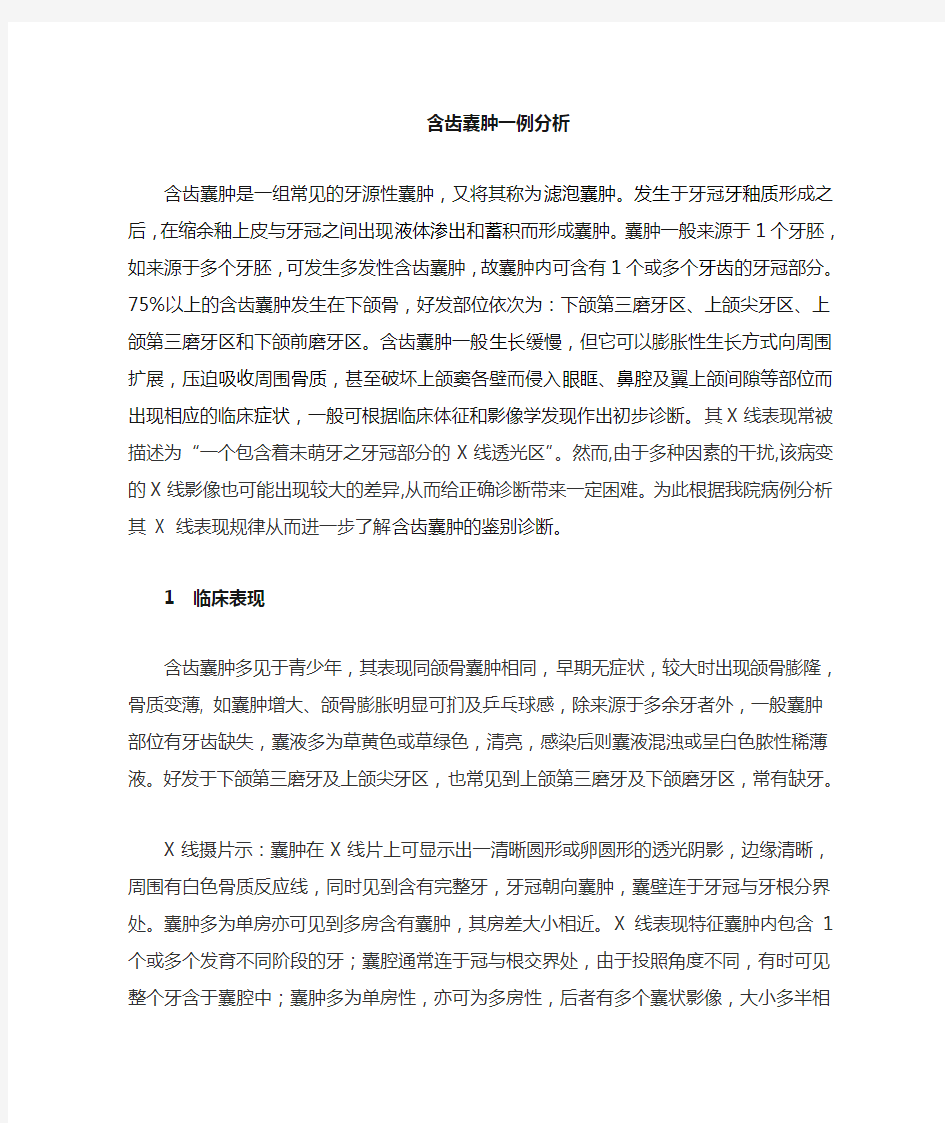 牙源性囊肿的诊断和治疗