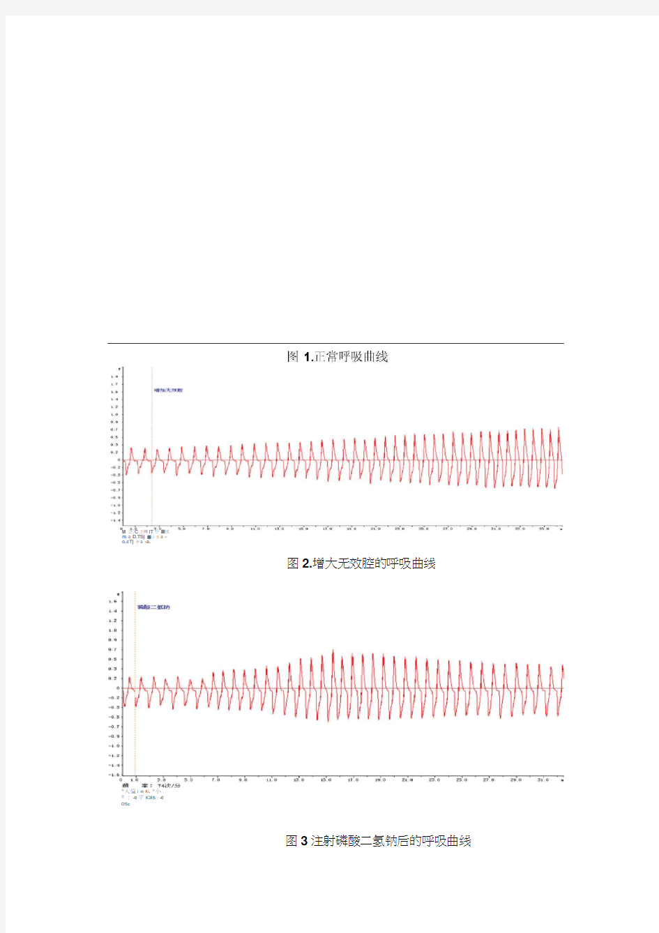 家兔呼吸运动神经的调节(实验报告)