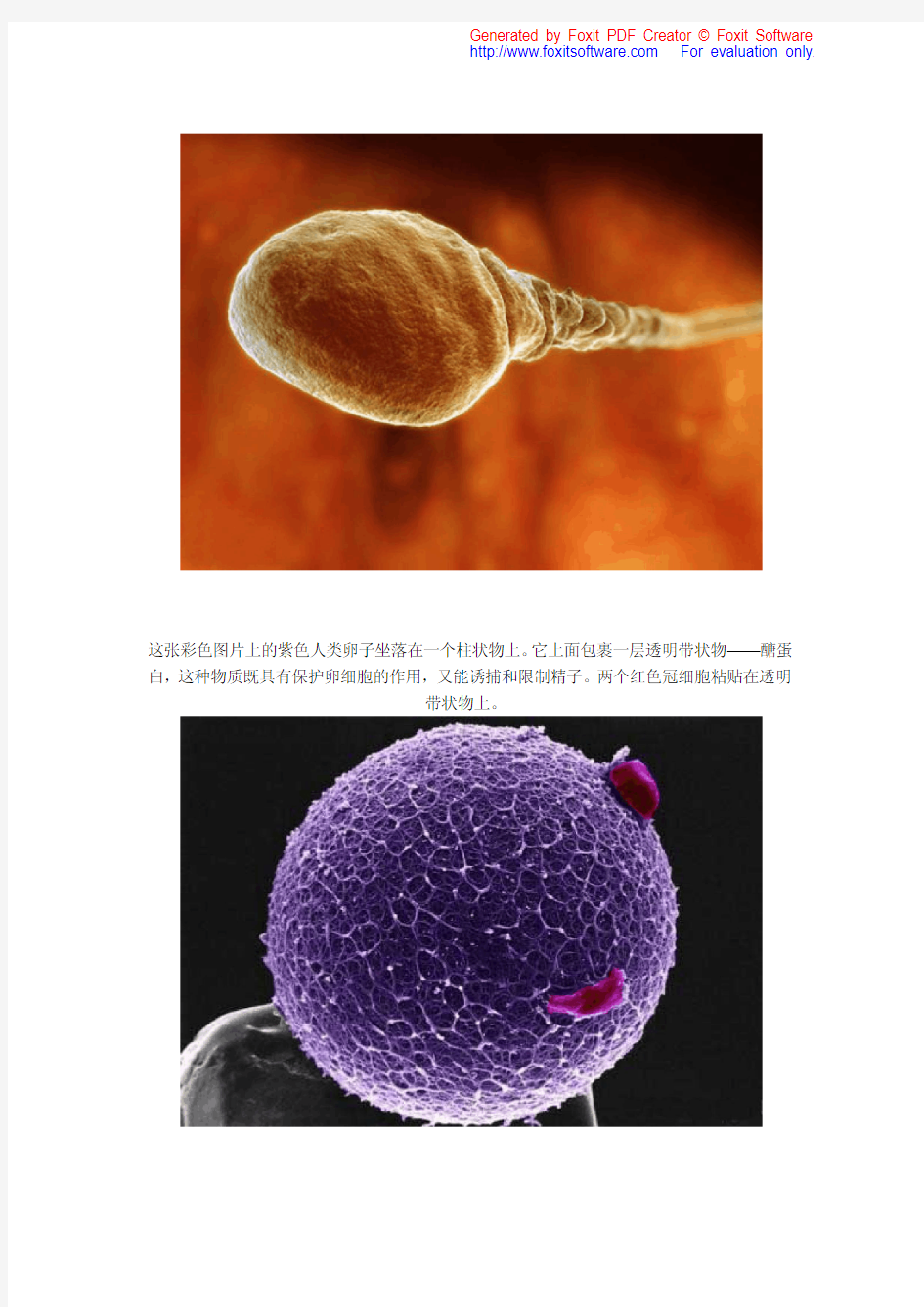 婴儿出生——一个精子发育成婴儿的全过程(目前最全的照片)